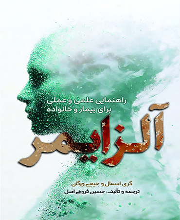 آلزایمر